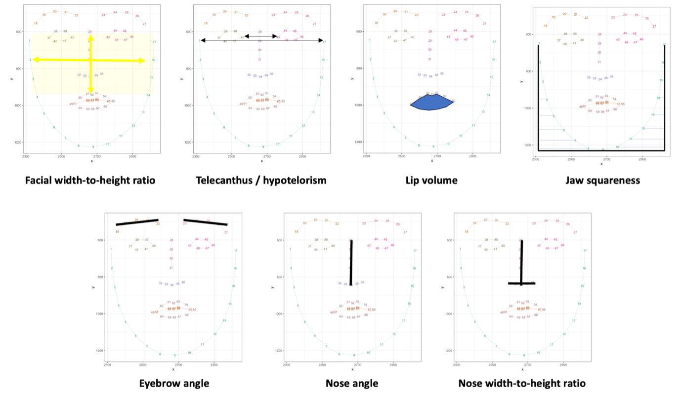 Facial landmarks used to measure facial proportions, lip volume, jaw squareness, and eyebrow and nose angles.
